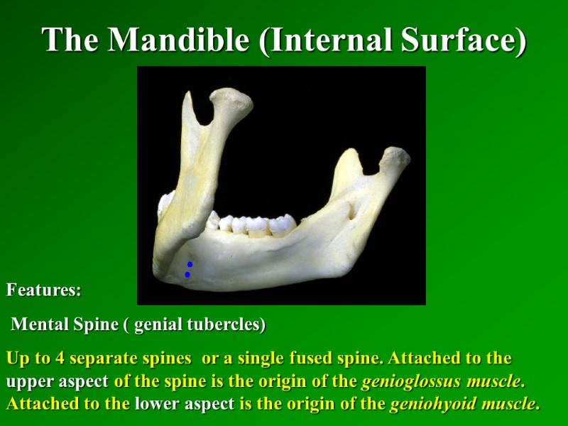 The Mandible (Internal Surface)   Features:  Mental Spine ( genial tubercles) Up
